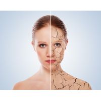 Догляд за сухою шкірою обличчя: головні правила та найкращі засоби догляду